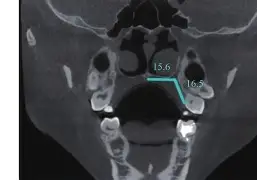 3胱釜ヌ羳嬂腭惴b賄S??觪?x?耺-?+芫鉊W╳F鏐 